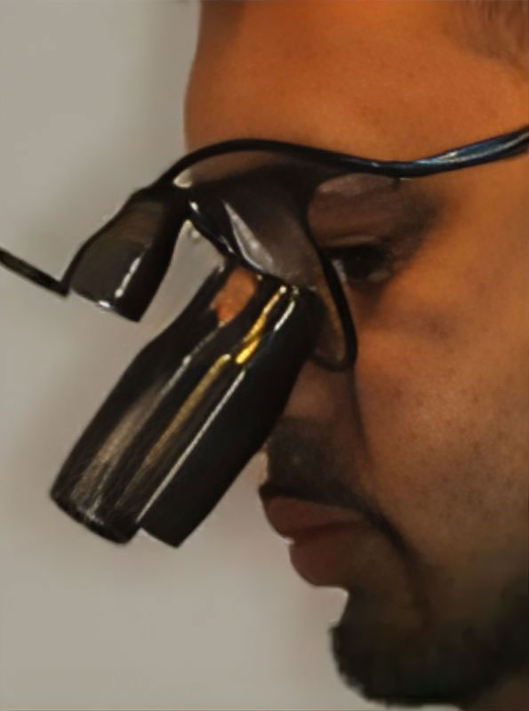 Root Canal Treatment