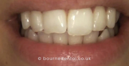 Chips Repaired Before