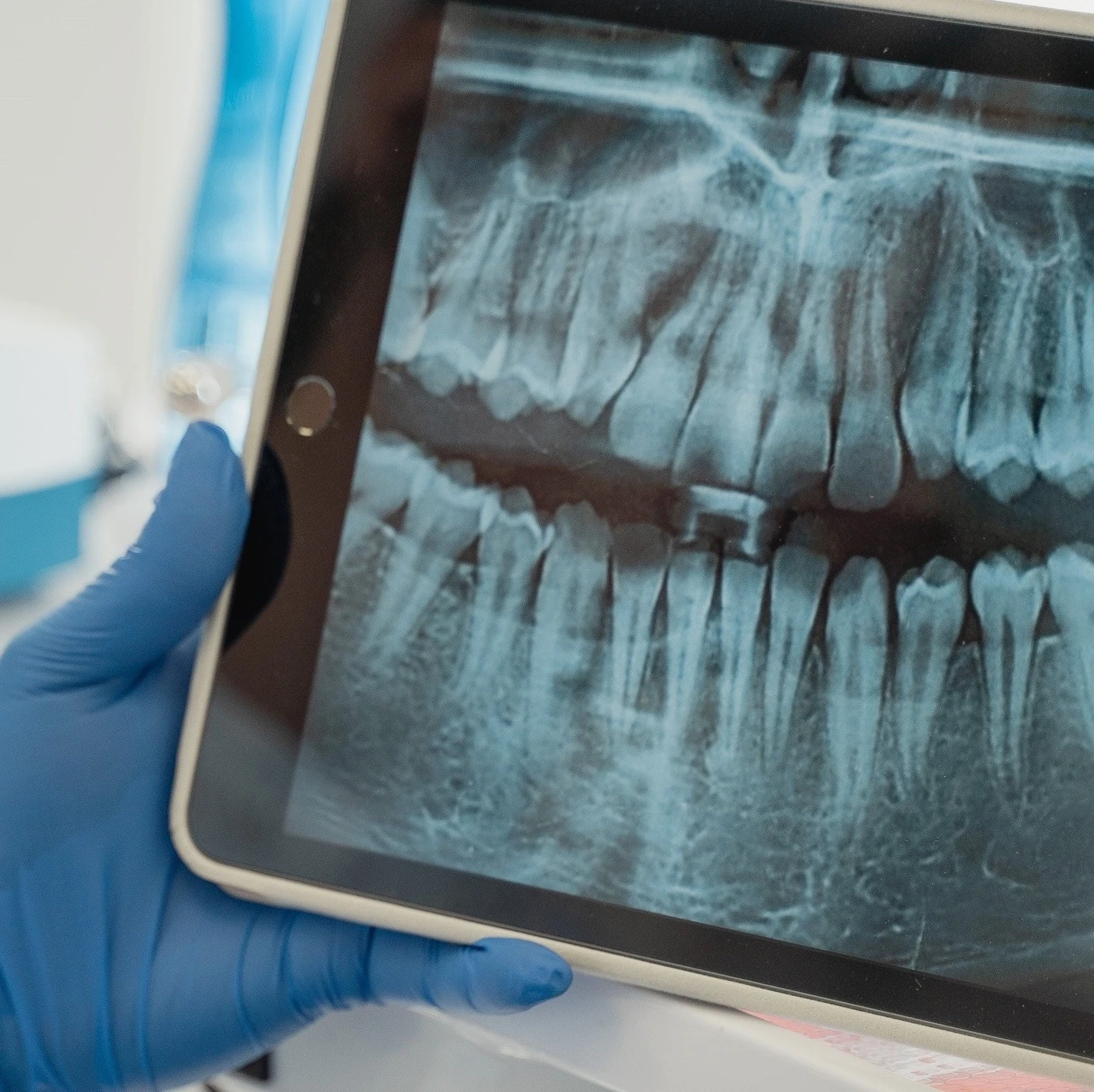 Comprehensive dental examination at Bourne Dental