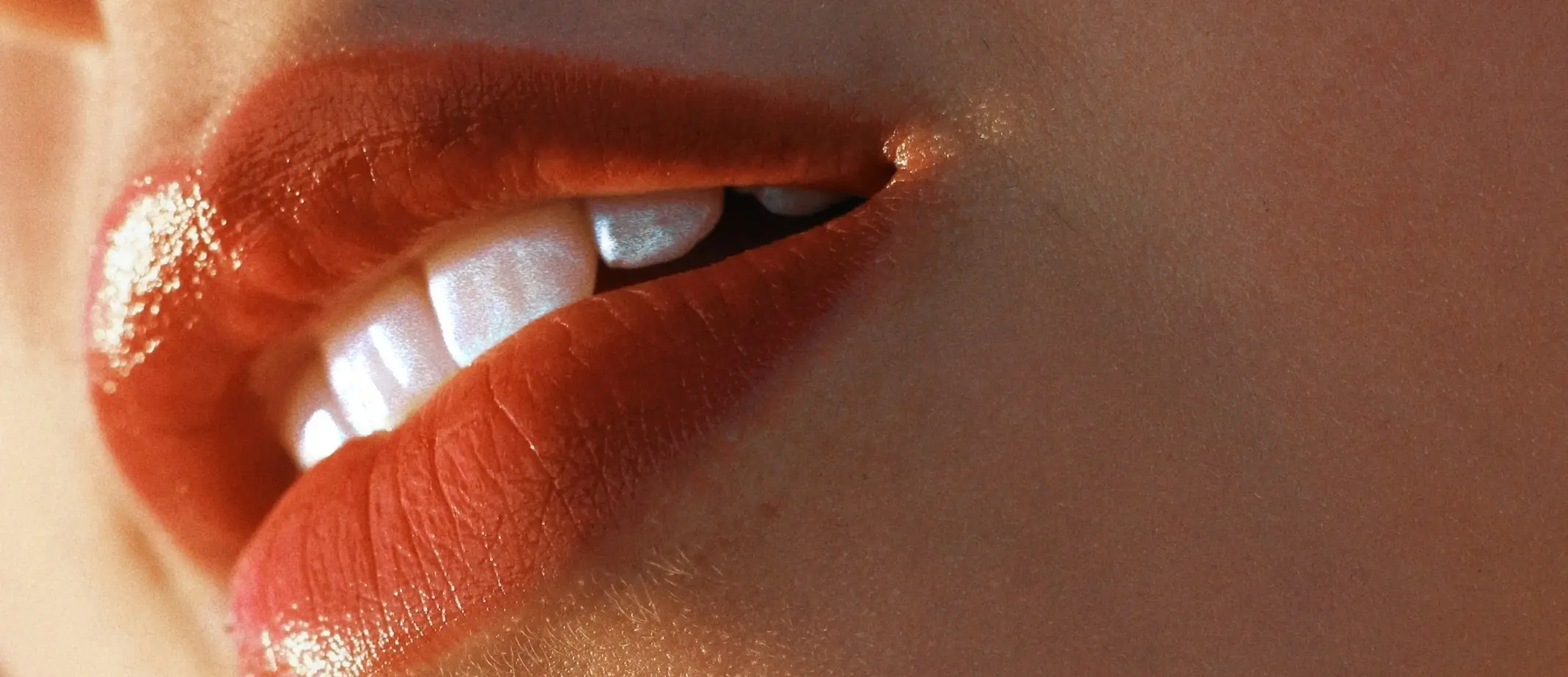 Teeth whitening results